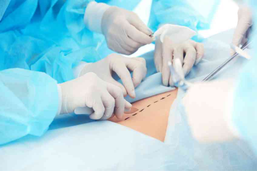 Doctors cutting stomach tissue in plastic surgery procedure
