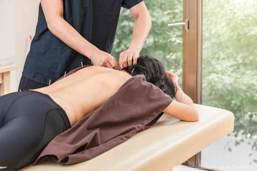 Acupuncture’s Pointed Health Benefits